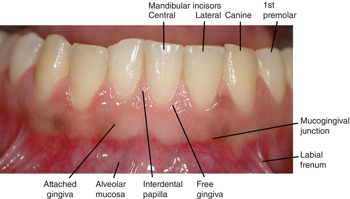 gingivae-gingivae