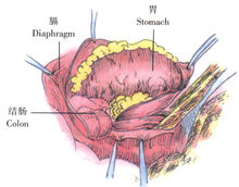 示意图10:胃、结肠、大网膜等腹内脏器