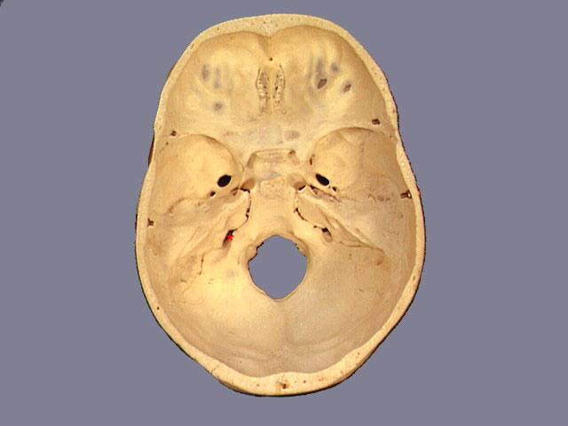 foramen lacerum что проходит