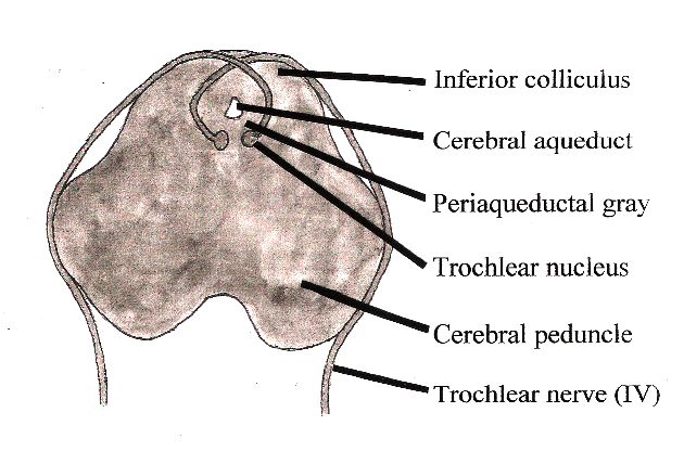 trochlear nerve